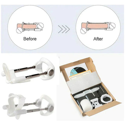 Vireon™ - Discreet Daily Comfort for Gentle Tissue Stretching